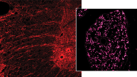 Descrit un nou fàrmac neuroprotector i accelerador  de la regeneració nerviosa