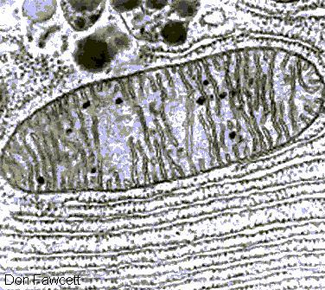 Hiperlactacidèmia en fills amb mare VIH