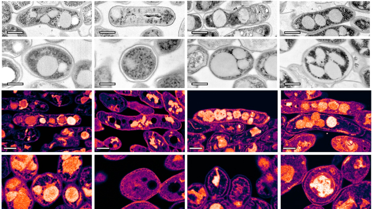 imatges de microscopi de micobacteris