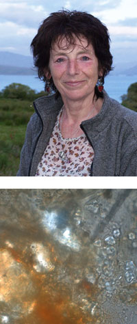 Karen Hardy (a dalt) i grup de grànuls de midó incrustats als càlculs dentals (a sota)