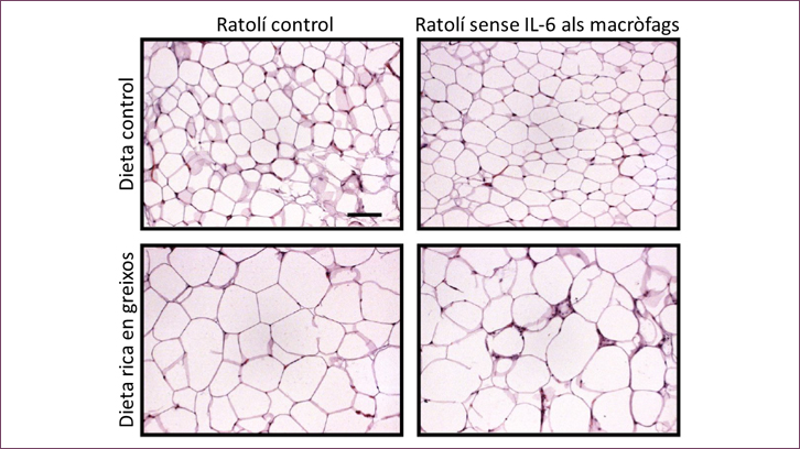 Com la interleucina 6 regula la inflamació del teixit adipós
