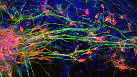 Neurona