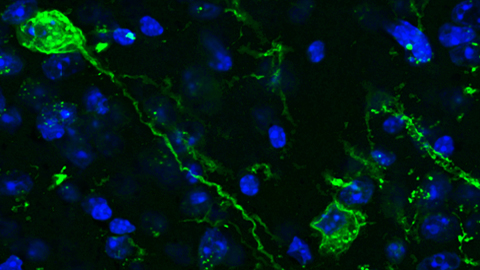 UAB Pioneers Study of the Memory Through Optogenetics