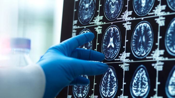 Imatge d'escàner cerebral humà