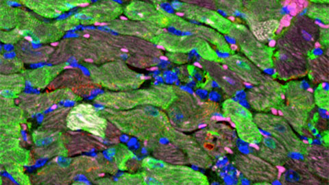 Imagen aumentada del corazón. Las células en color verde representan los cardiomiocitos que han sido