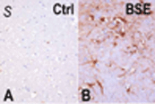 Encefalopatia Espongiforme Bovina