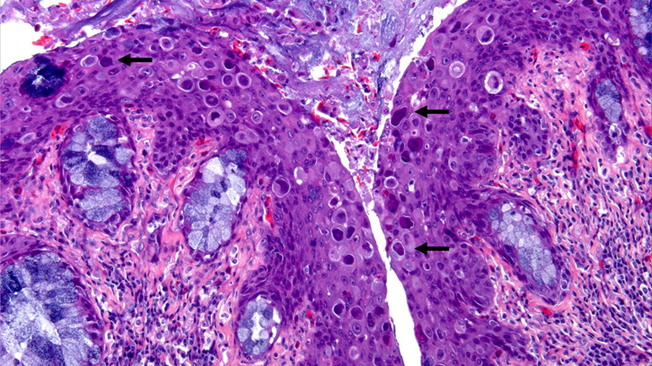 tortuga adenovirus