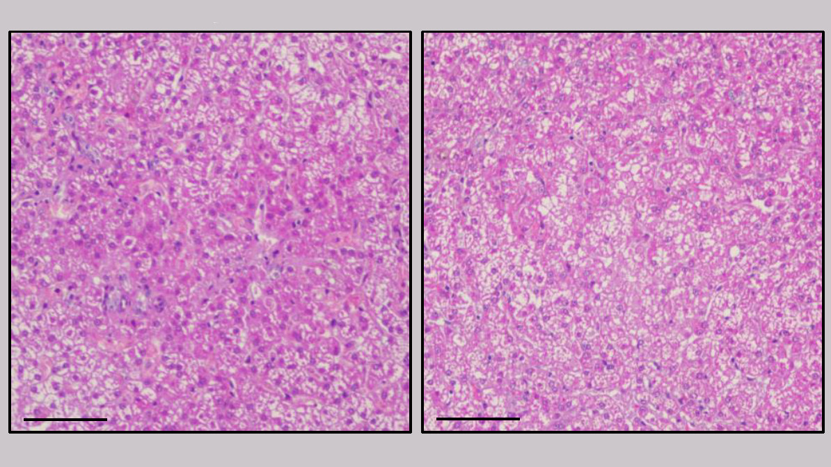 Histopathological study of the liver