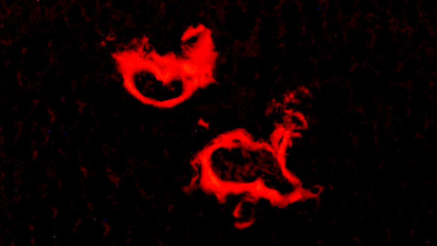 amiloidosis al parènquima dels vasos sanguinis del fetge en ratolins model de malaltia d¿Alzheimer 