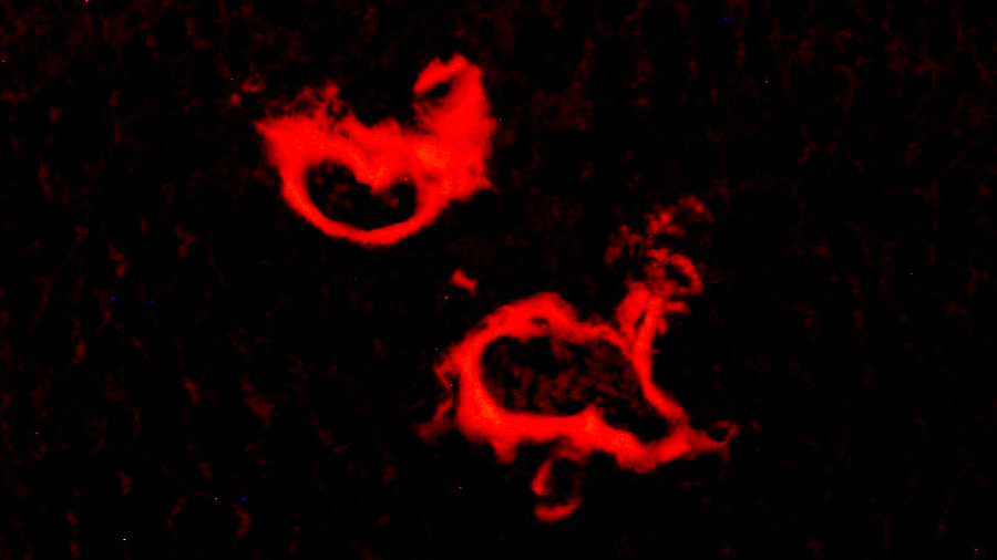 amiloidosis al parènquima dels vasos sanguinis del fetge en ratolins model de malaltia d¿Alzheimer