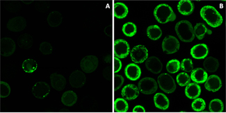 Proteïna amb Escherichia coli