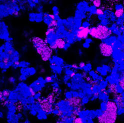 Tractament biològic per evitar l'eutrofització