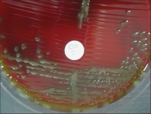 Deteccio Pneumonia Orina