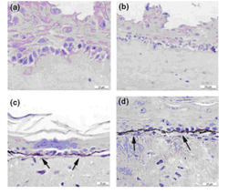 Figura 3: Anàlisi immunohistoquímic dels components de membrana basal: expressió de col·lagen tipus 
