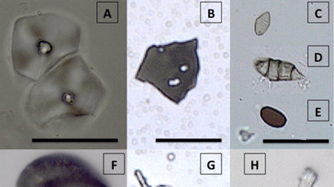 Microfósiles extraídos de cálculo dental