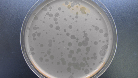 Placa con la bacteria de la Salmonella infectado por diferentes bacteriógafos.