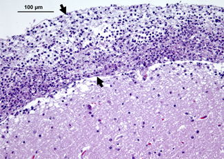 Patologia clínica H. parasuis