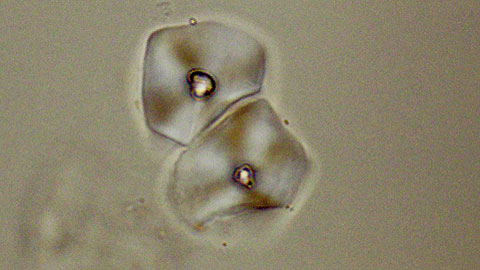 Microfossil extracted from dental calculus of hominins of Qesem Cave (Israel)