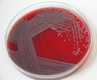 El bacteri Salmonella enterica