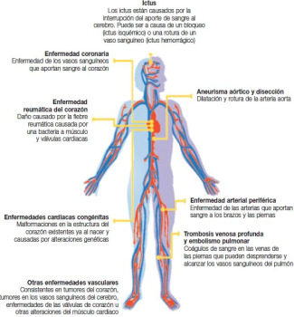 Guia ictus