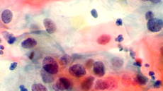 IMG_doctorat_cirugia_foto1