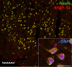 Imatge del cervell isquèmic d'una rata