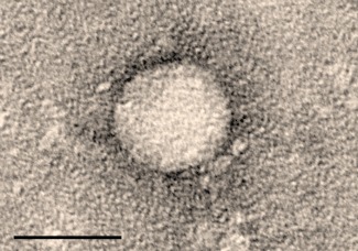 Virus Granja