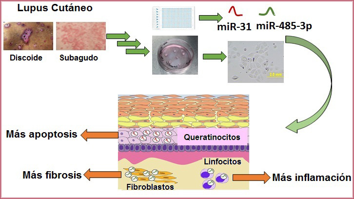 lupus microRNA 