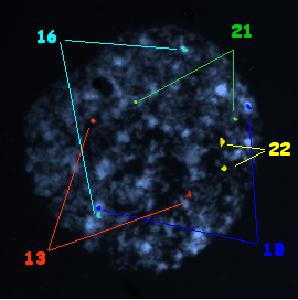 Biopsia blastòmer