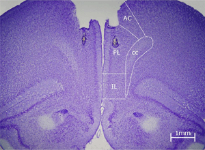 Escorça prelímbica.