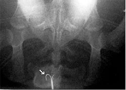 Radiografia d'una tortuga babua que s'ha empassat un ham