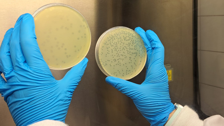 Plaques petri amb cultiu