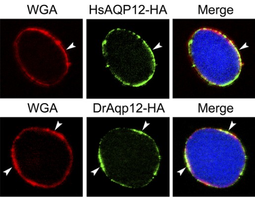 Imatges de microscopia de AQP12