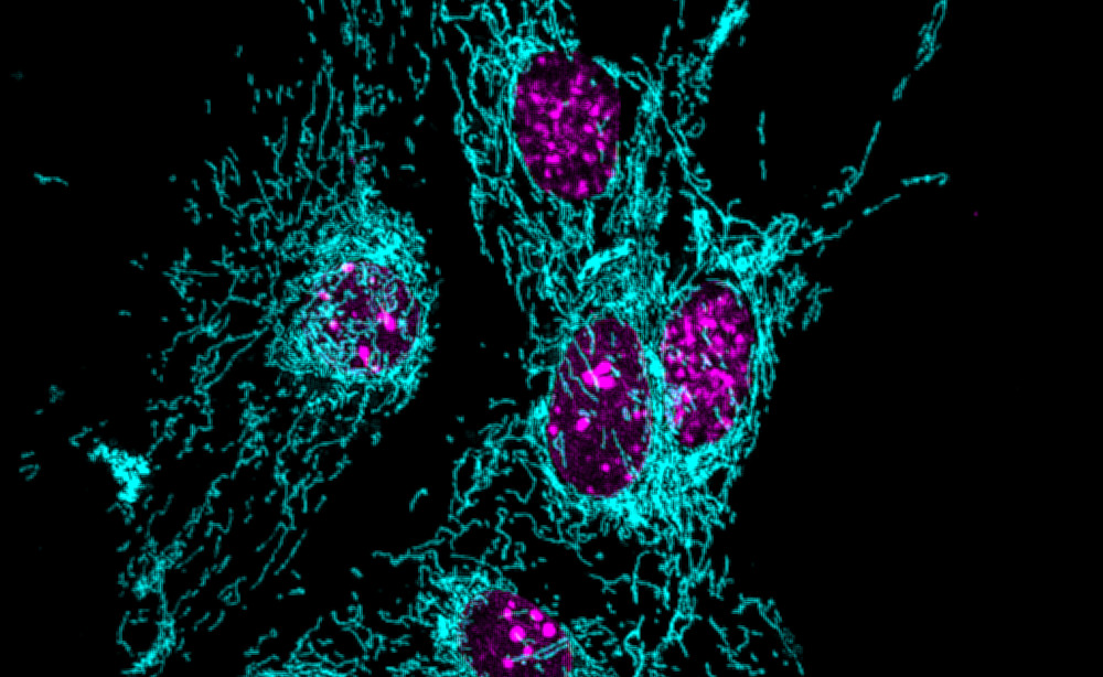 IG_AQuintana_projectes