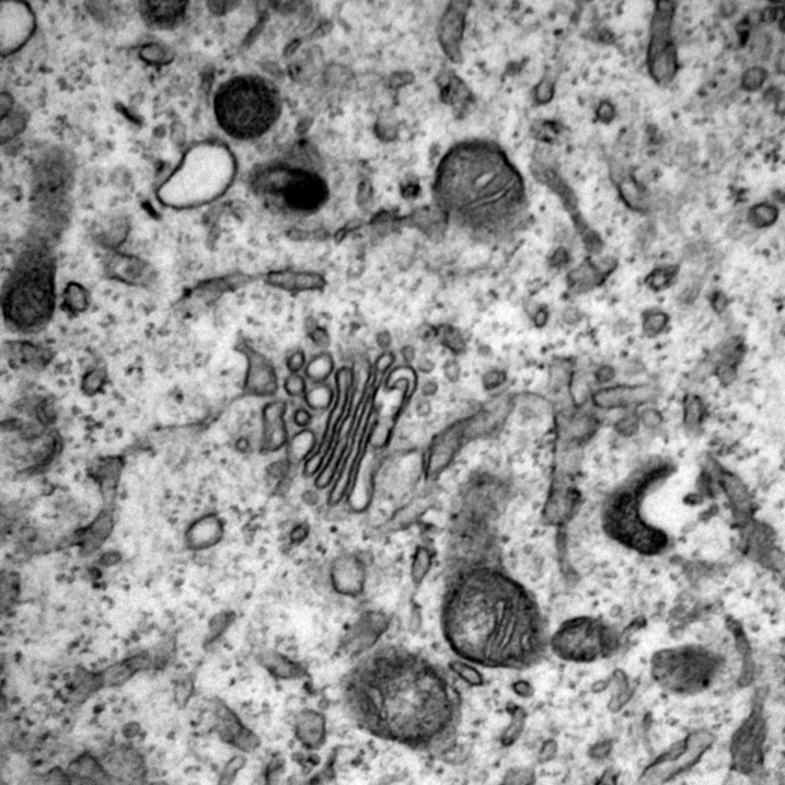 Aparell de Golgi observat en un teixit nerviós de llangardaix (imatge de TEM)