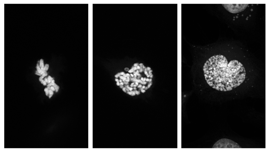 Muntatge d'imatges de nuclis cel·lulars observats amb Airyscan