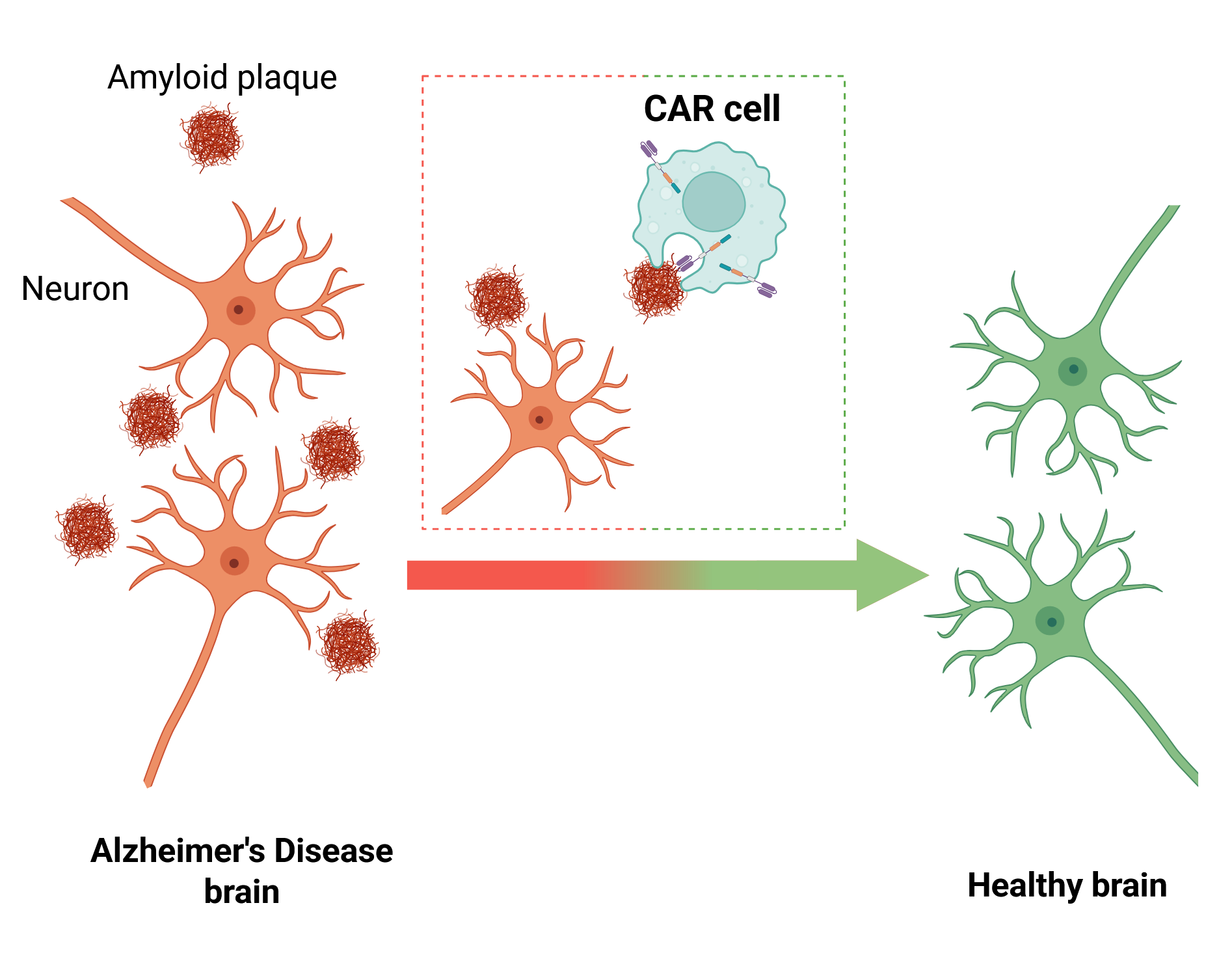 Image of healthy neurones and neurones affected by the disease