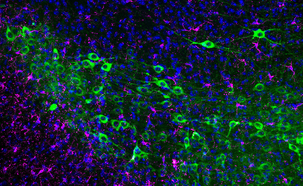 IG_NOT_260202_immunoterapiaparkinson (En)