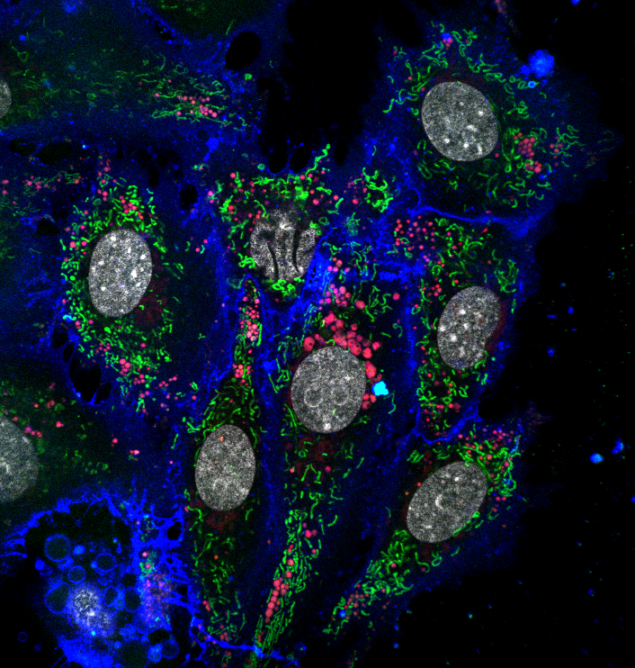 Células HeLa observadas con confocal. Las células están marcadas con tinciones específicas para observar la membrana plasmática, el núcleo y las mitocondrias.