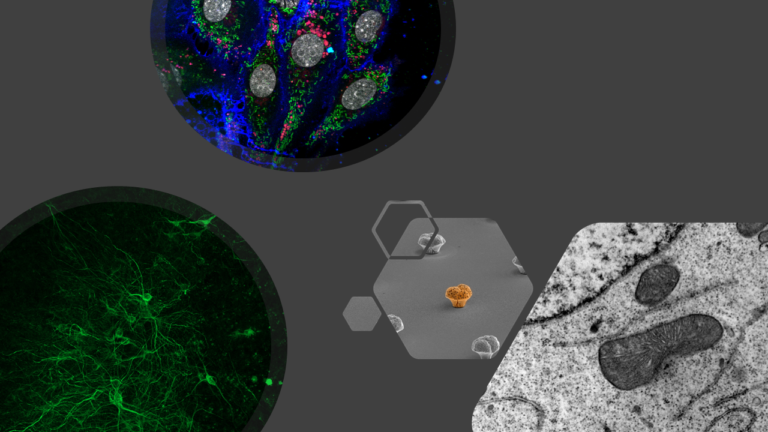 Composición de imágenes de microscopía confocal y de electrónica