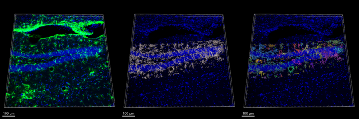 Identificación de neuronas con el programa IMARIS
