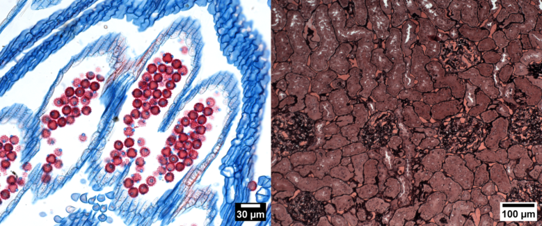 Imágenes de muestra realizadas con la cámara Axiocam 305 color (izquierda: tejido vegetal donde se observa polen; derecha: sección de riñón de rata).