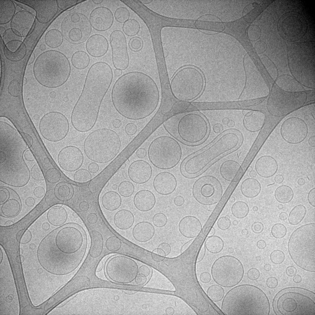 Liposomas observados en condiciones criogénicas.