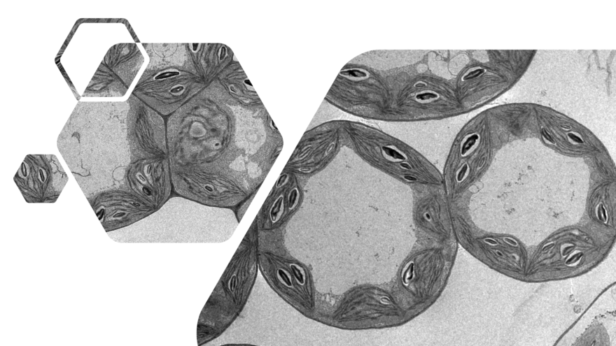 		Montaje de imágenes de hojas de plantas observadas con TEM. Concretamente, se observan las estructuras internas de los cloroplastos, los tilacoides.