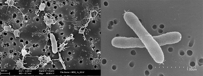  imatges a microscopi del bacteri Parvicella tangerina i el Lysobacter luteus 