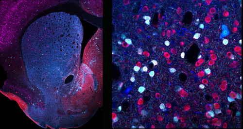 Neurones amb receptors D2