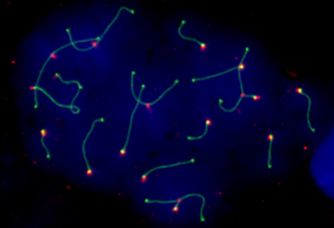Célula germinal (espermatocito) de ratón con reordenamientos cromosómicos.